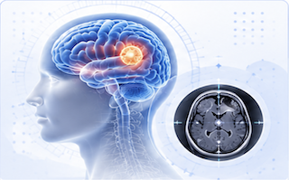 Brain imaging and neuro-oncology care illustration