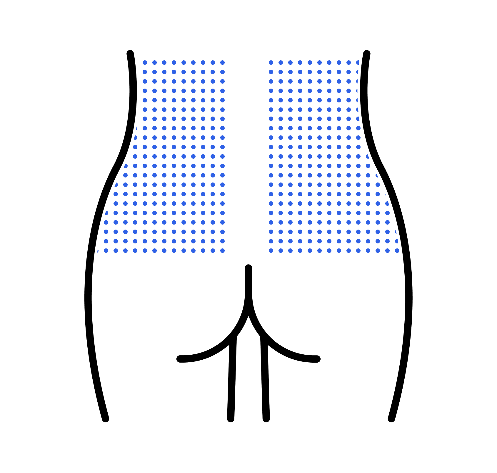 Side of upper hips infusion site
