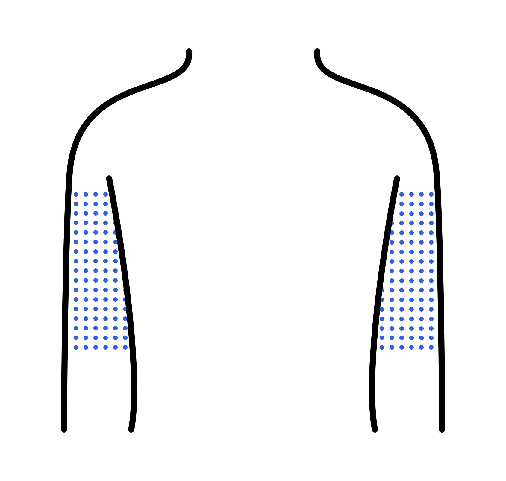 Back of arms infusion site