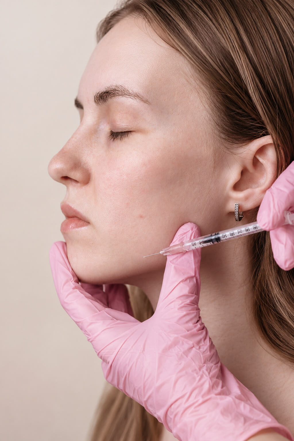Medical provider performing an injectable lip treatment to soften vertical lip lines and improve lip support and definition.