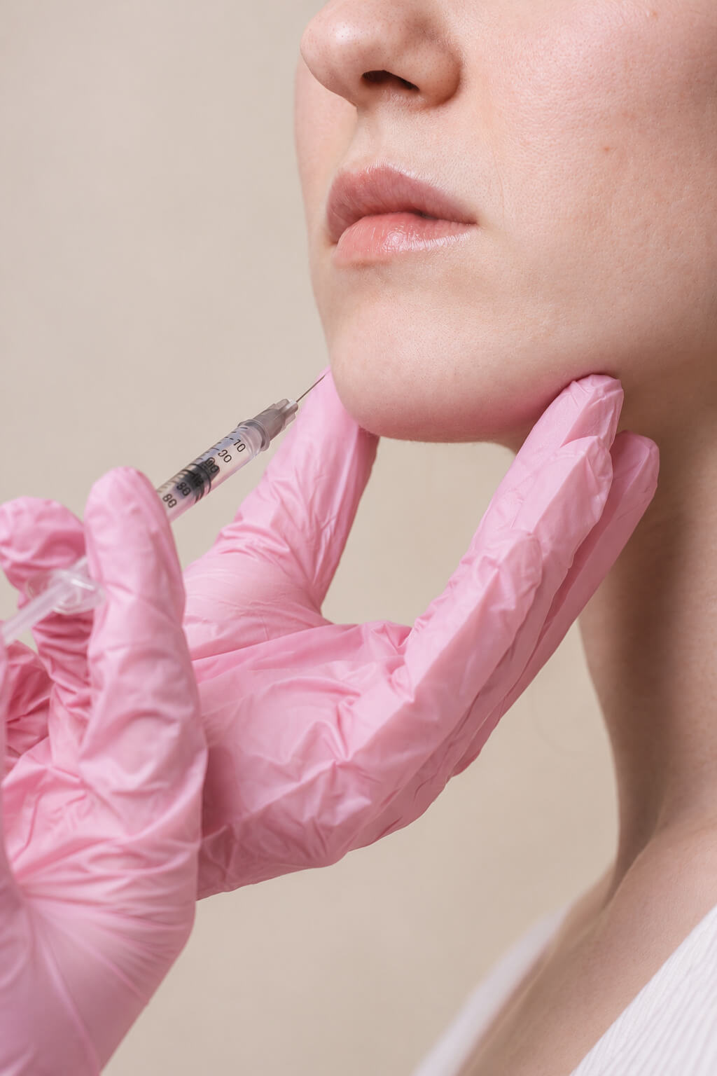 Medical provider performing an injectable lip treatment to soften vertical lip lines and improve lip support and definition.