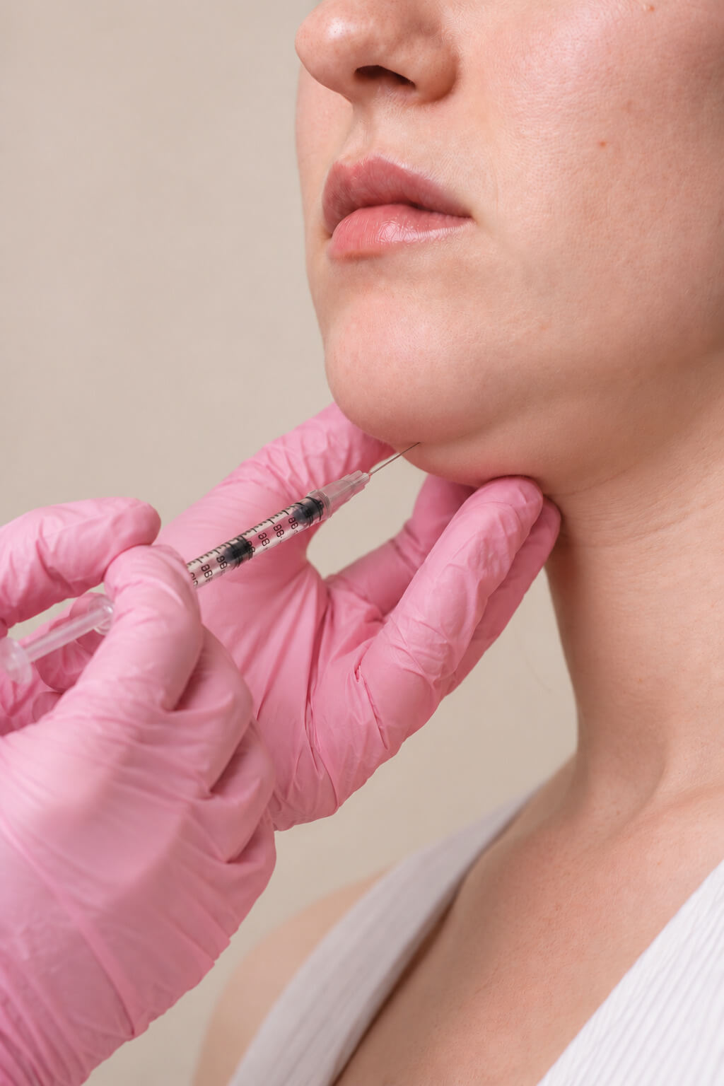 Medical provider performing an injectable lip treatment to soften vertical lip lines and improve lip support and definition.