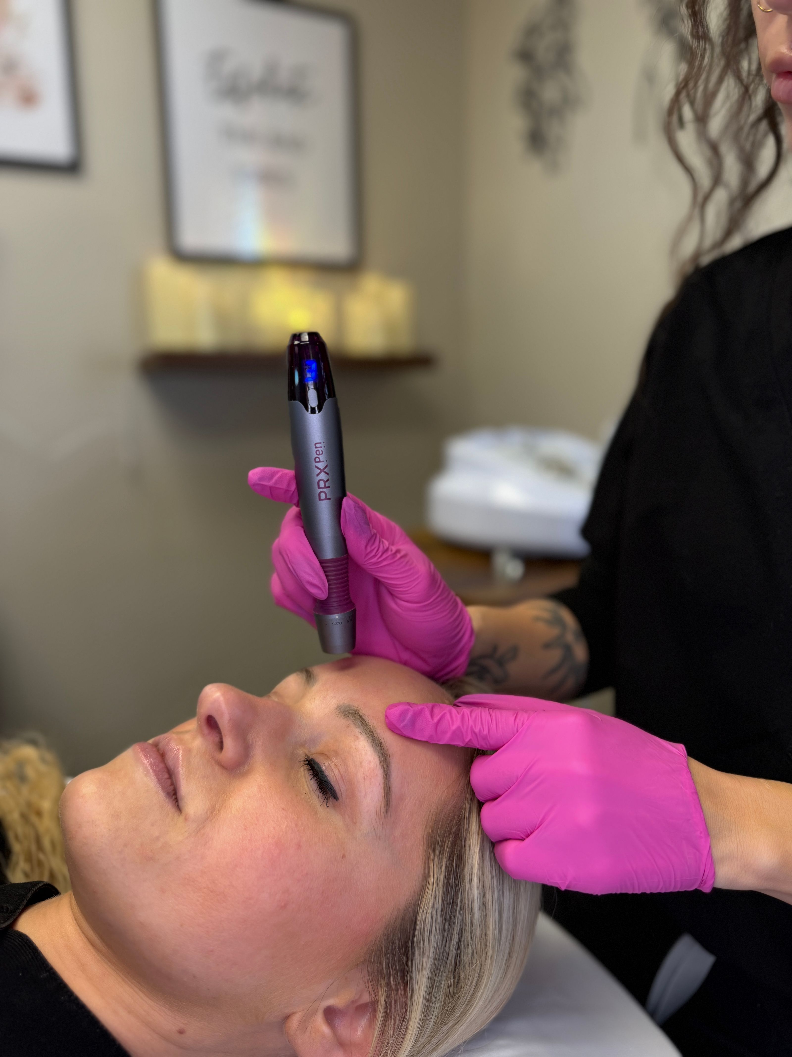 Provider performing PRX microneedling treatment to improve skin texture, collagen production, and overall skin rejuvenation.