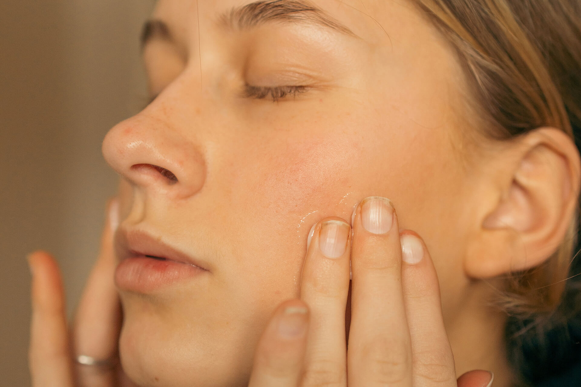 Woman applying skincare product to calm and hydrate the skin before or after microneedling treatment.
