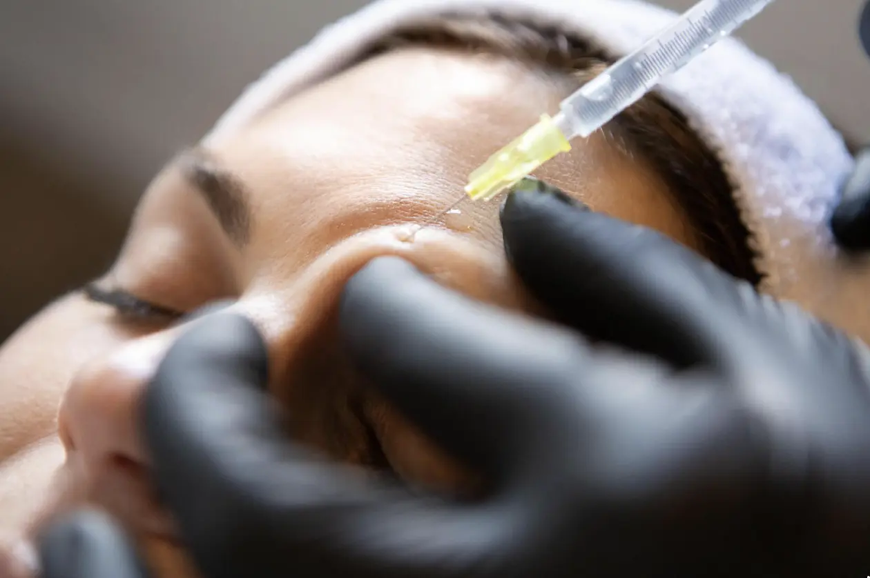 Close-up of a neurotoxin injection being administered to smooth forehead wrinkles during a cosmetic treatment