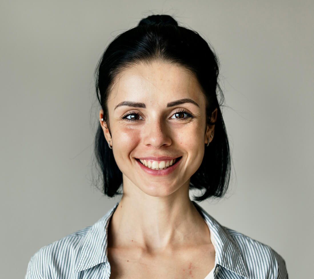 Woman in her early 30s smiling with subtle fine lines around the eyes, showing the early signs of skin aging.