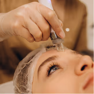 Close-up of a cosmetologist performing microneedling treatment on a woman's forehead.