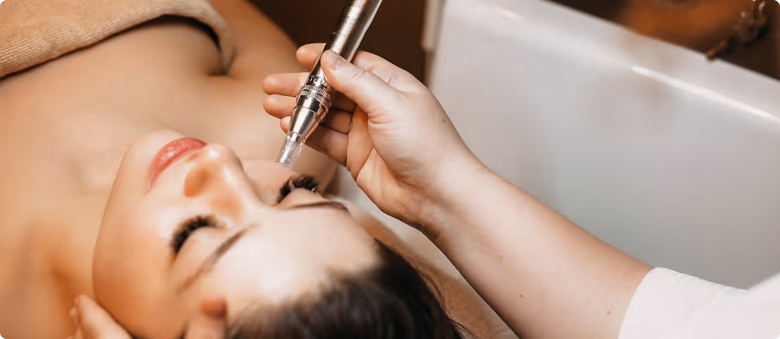 Close-up of a woman receiving a facial microdermabrasion treatment on her cheek while lying down with eyes closed.