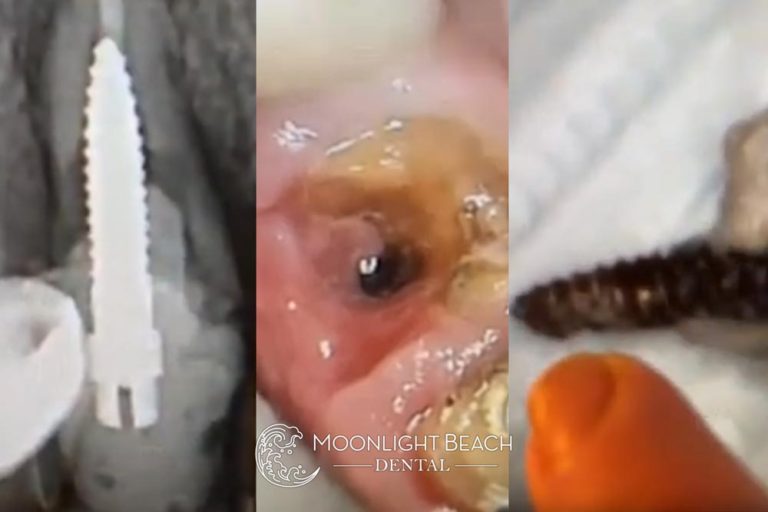 Part 2: More On The Guy With Archaic Materials In His Mouth