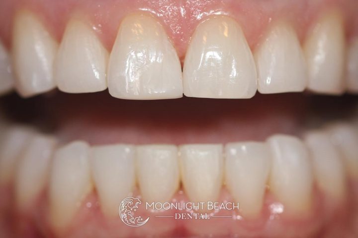 Transformation Wednesday