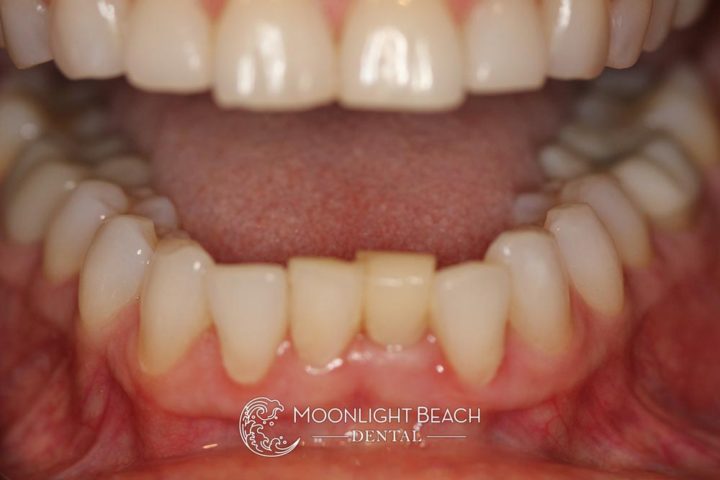 Transformation Wednesday