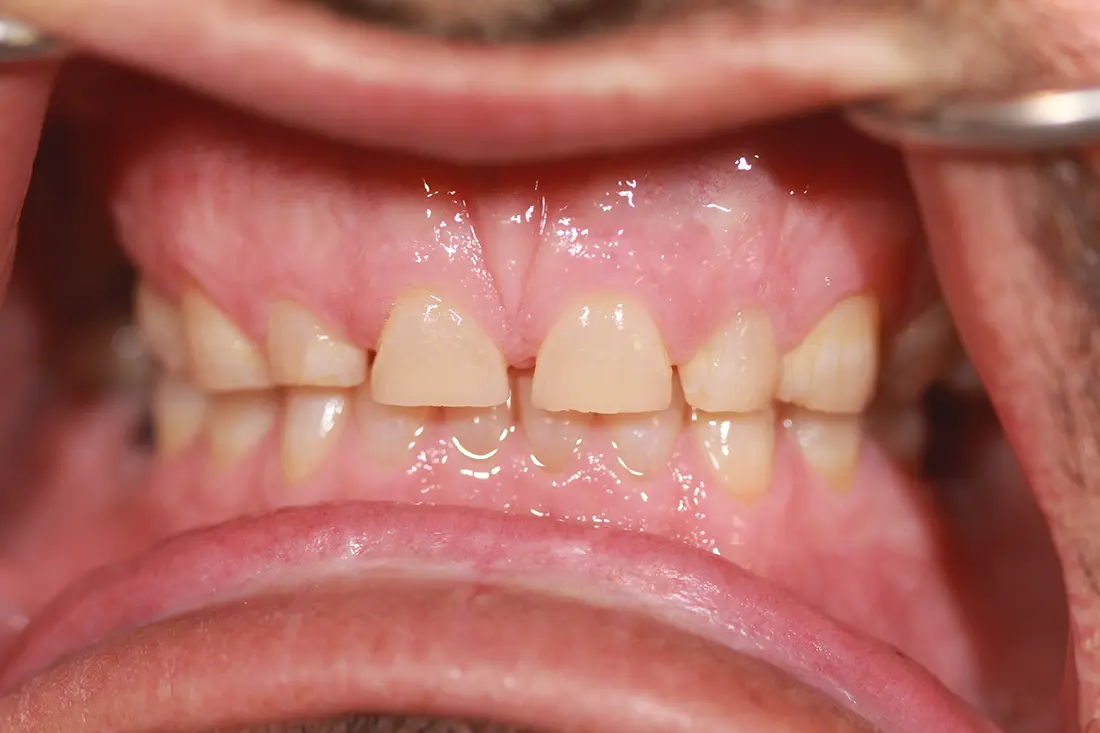 Renewing the Size & Look of Teeth