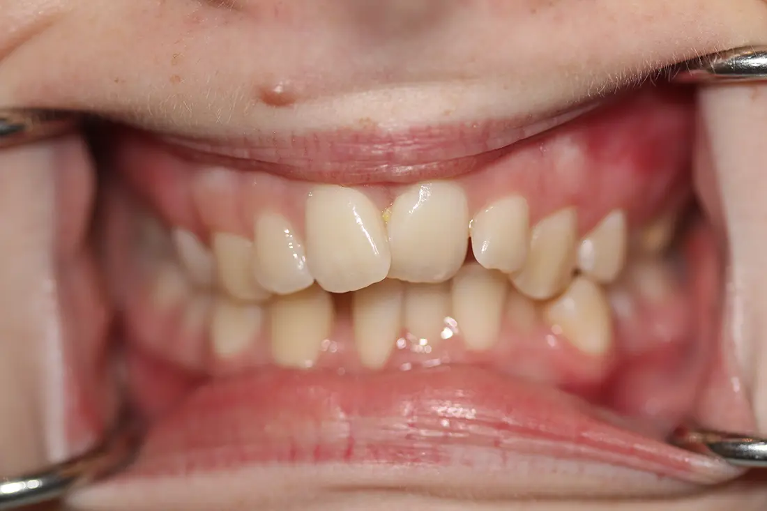 A Conservative Approach