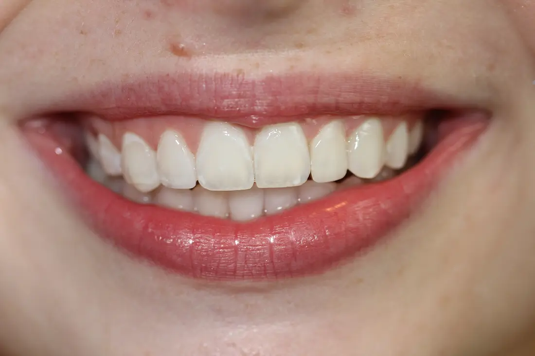 A Conservative Approach