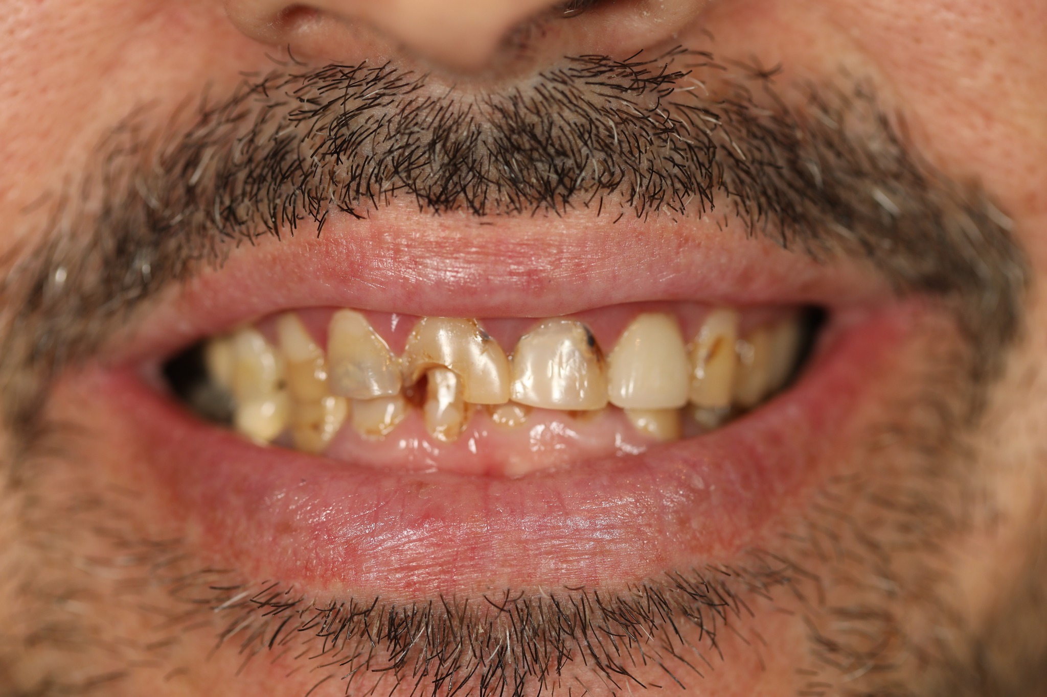 Before & After: From Patchwork to Perfection