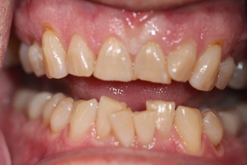 Before & After: Transforming Smiles and Lives