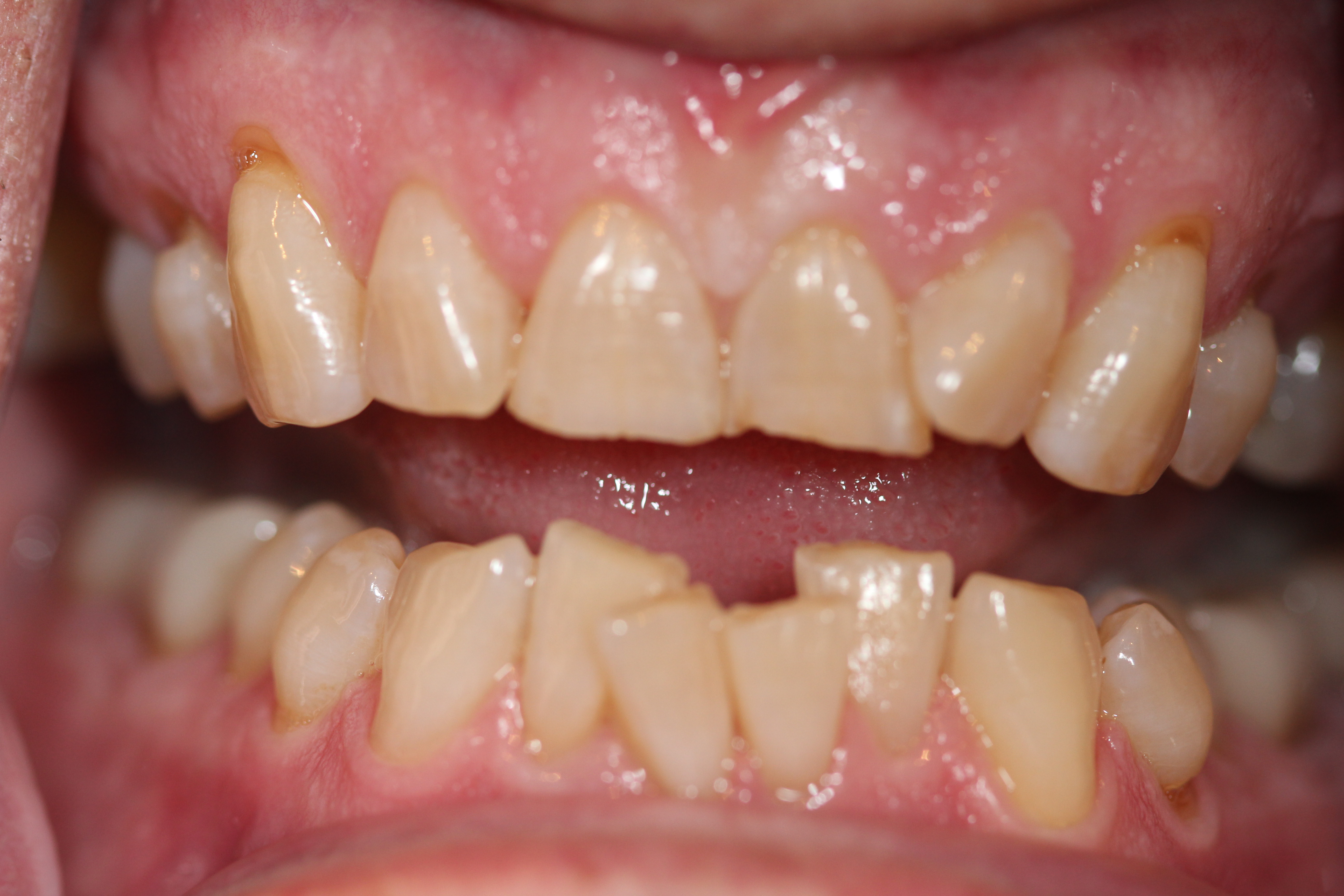 Before & After: Transforming Smiles and Lives