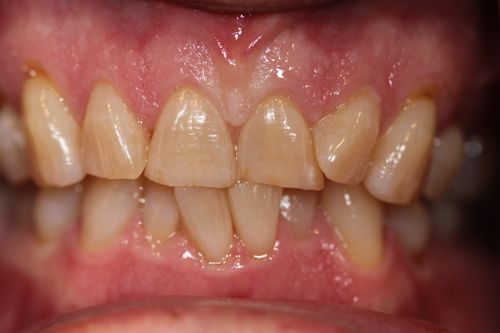 Before & After: Transforming Smiles and Lives