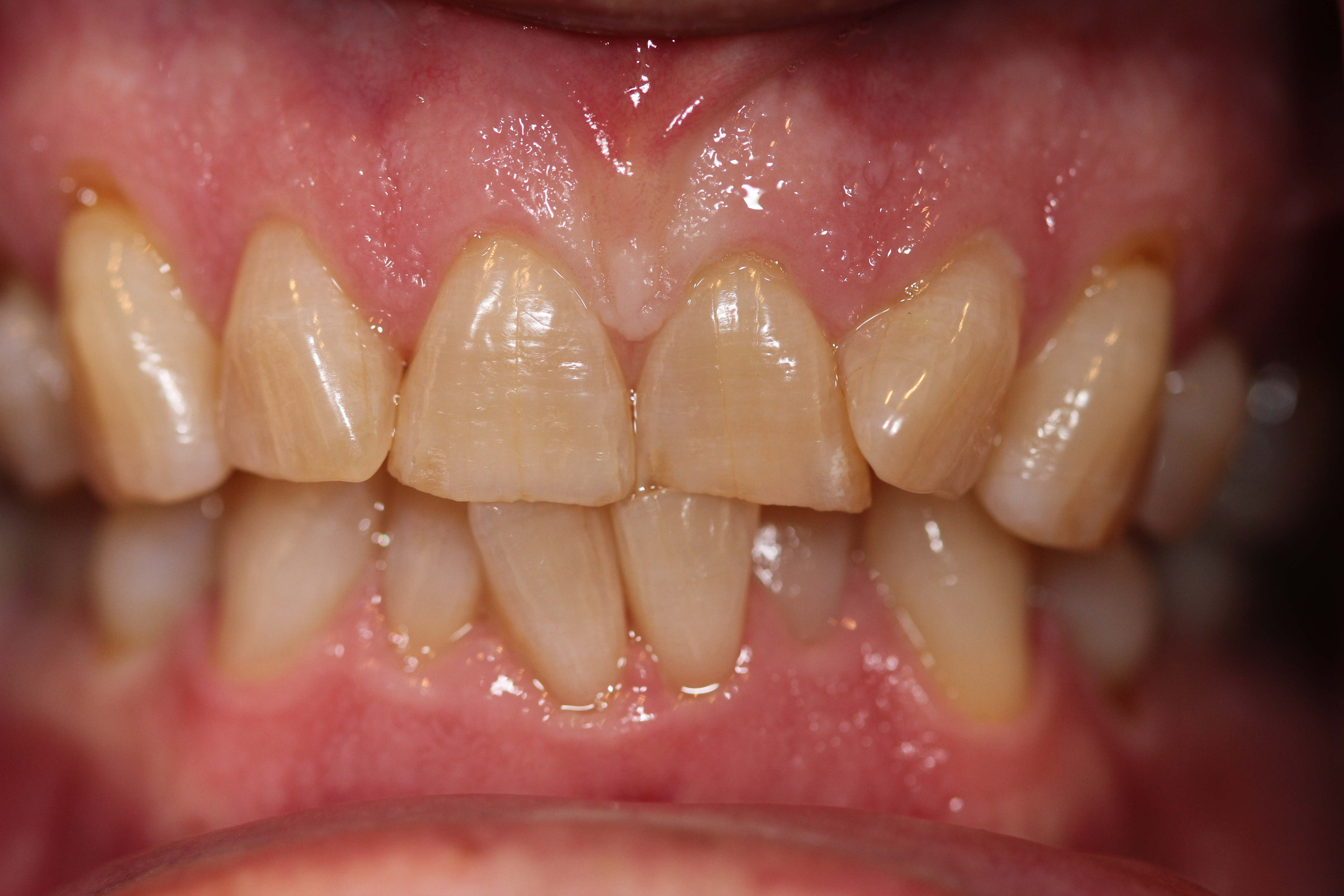 Before & After: Transforming Smiles and Lives