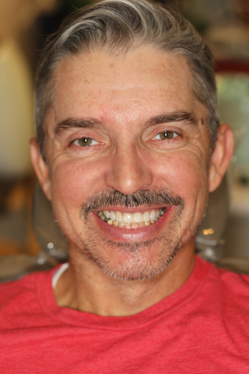 Before & After: A Healthier, Happier Smile!