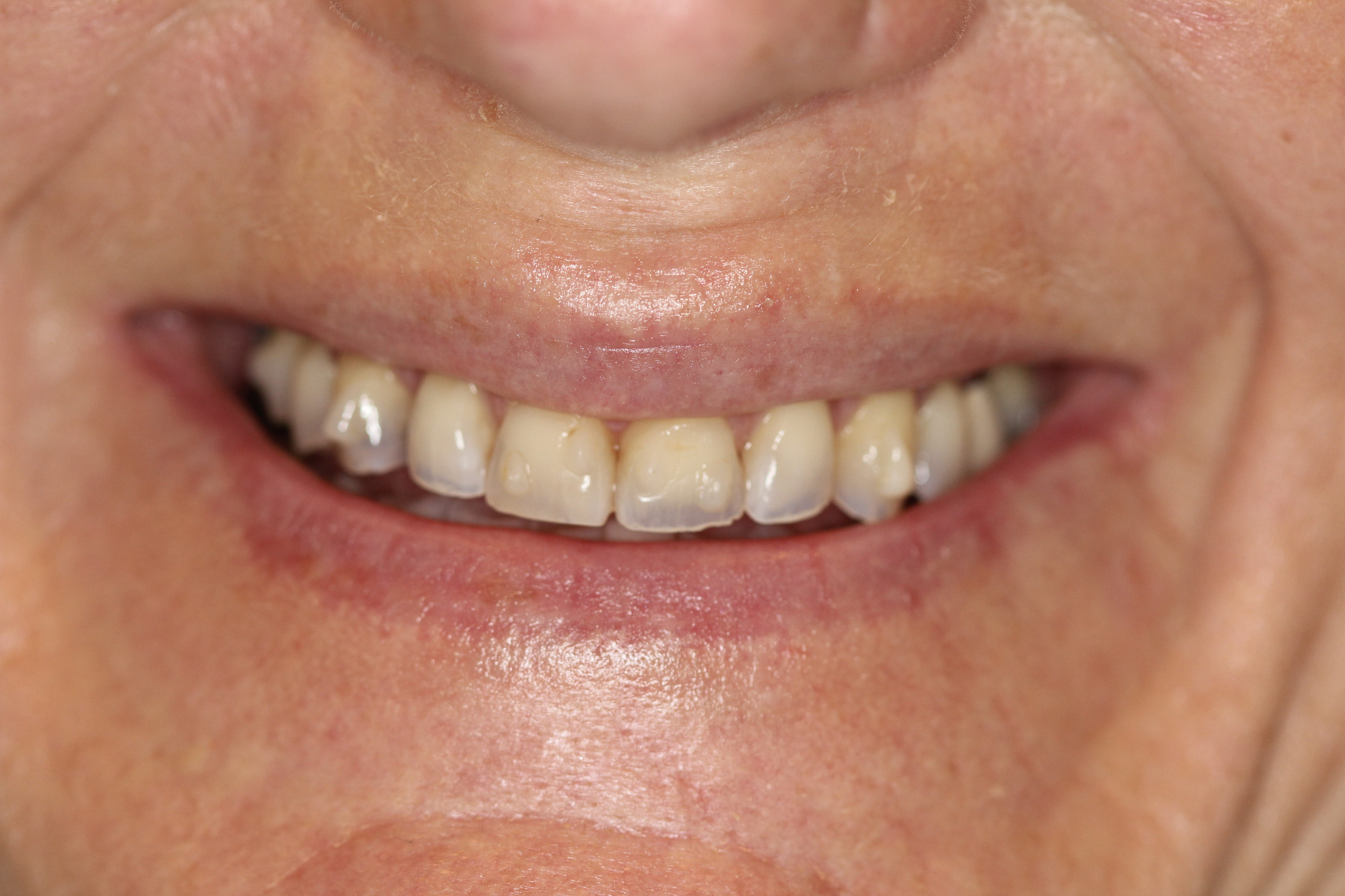 Before & After: A Life-Changing Transformation!