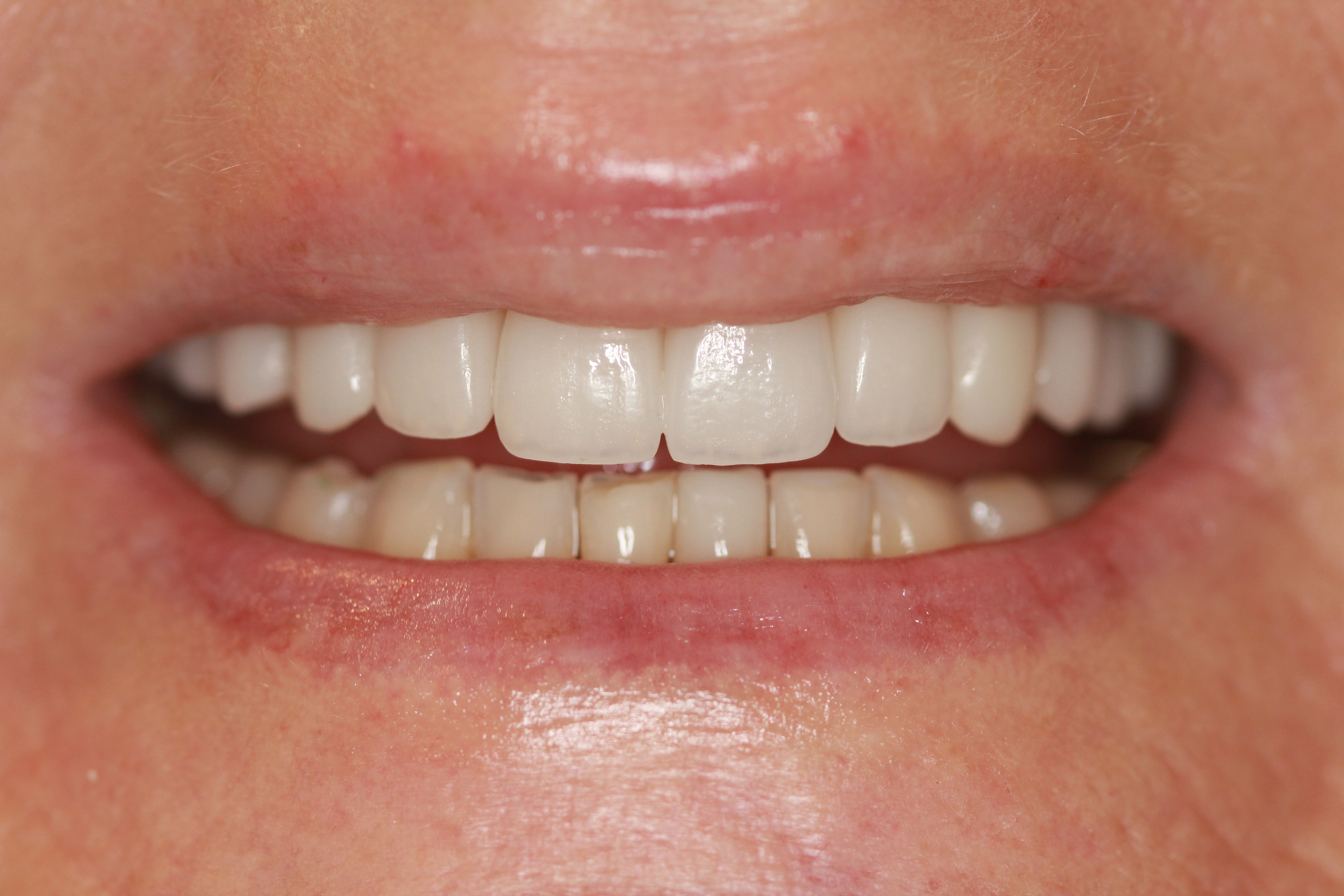 Before & After: A Life-Changing Transformation!