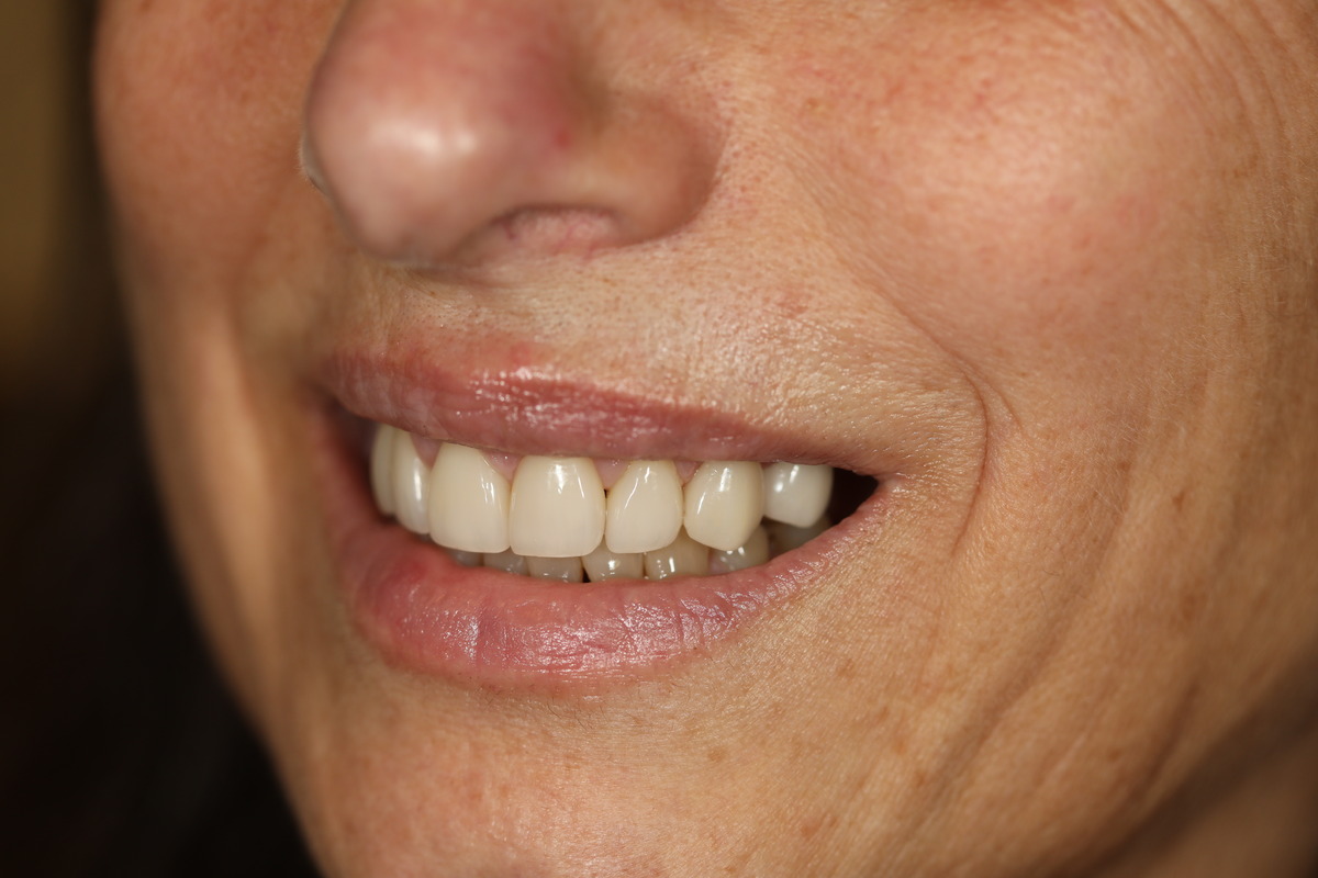 Before & After: A Natural Makeover in Progress