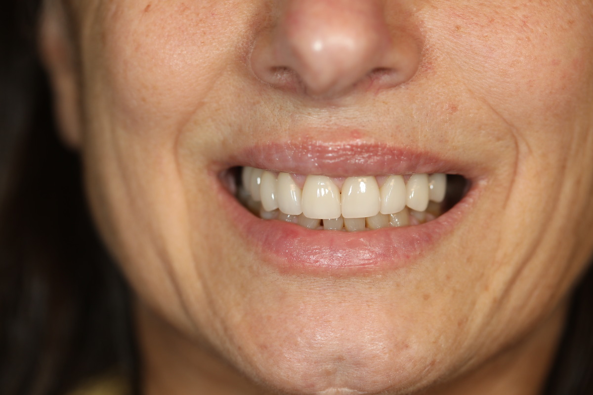 Before & After: A Natural Makeover in Progress