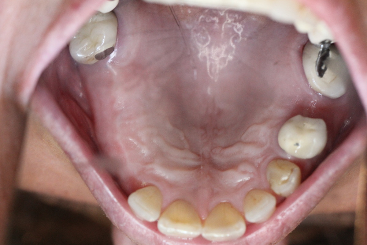 Before & After: Restoring Health and Confidence