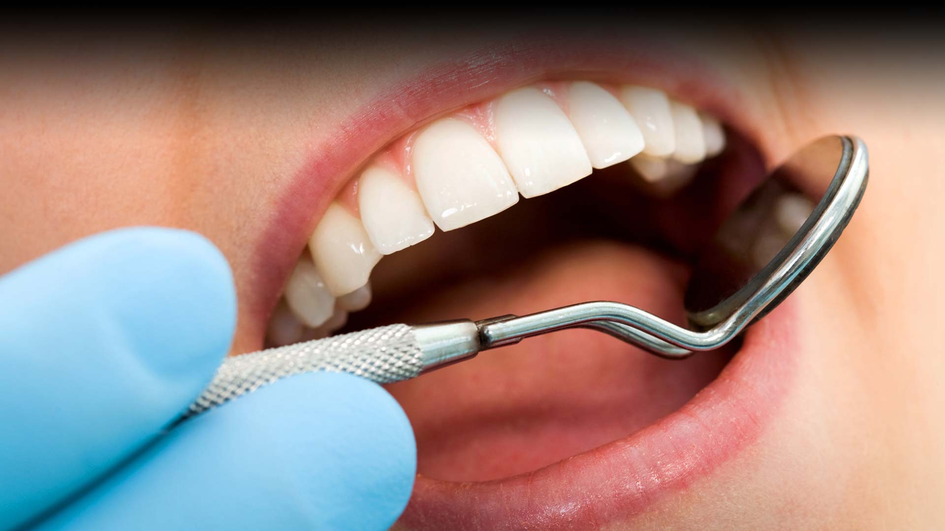 Why Holistic Dentistry Emphasizes Prevention Over Intervention