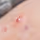 Close-up of skin with a small red bump or pimple.