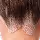 Close-up of a person's scalp showing thinning hair and visible skin, indicating hair loss.