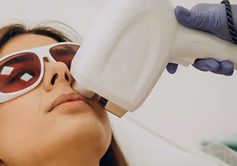 Close-up of a woman wearing protective glasses receiving a facial laser treatment.