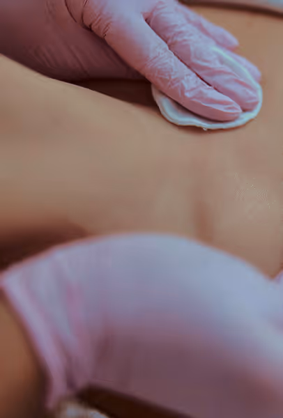 Gloved hand applying a cotton pad to a person's back during a skincare or medical treatment.