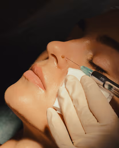 Close-up of a woman receiving an injection near a small mole on her nose by a gloved hand.