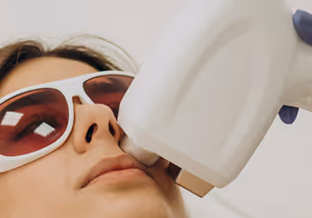 Close-up of a person wearing protective glasses receiving a cosmetic laser treatment on the upper lip.