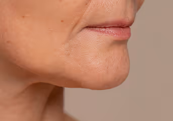 Close-up of an older person's chin and lower face showing natural skin texture and wrinkles.