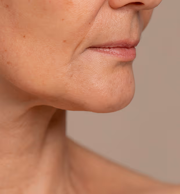 Close-up of a mature person's lower face showing natural skin texture and wrinkles around the mouth and chin.