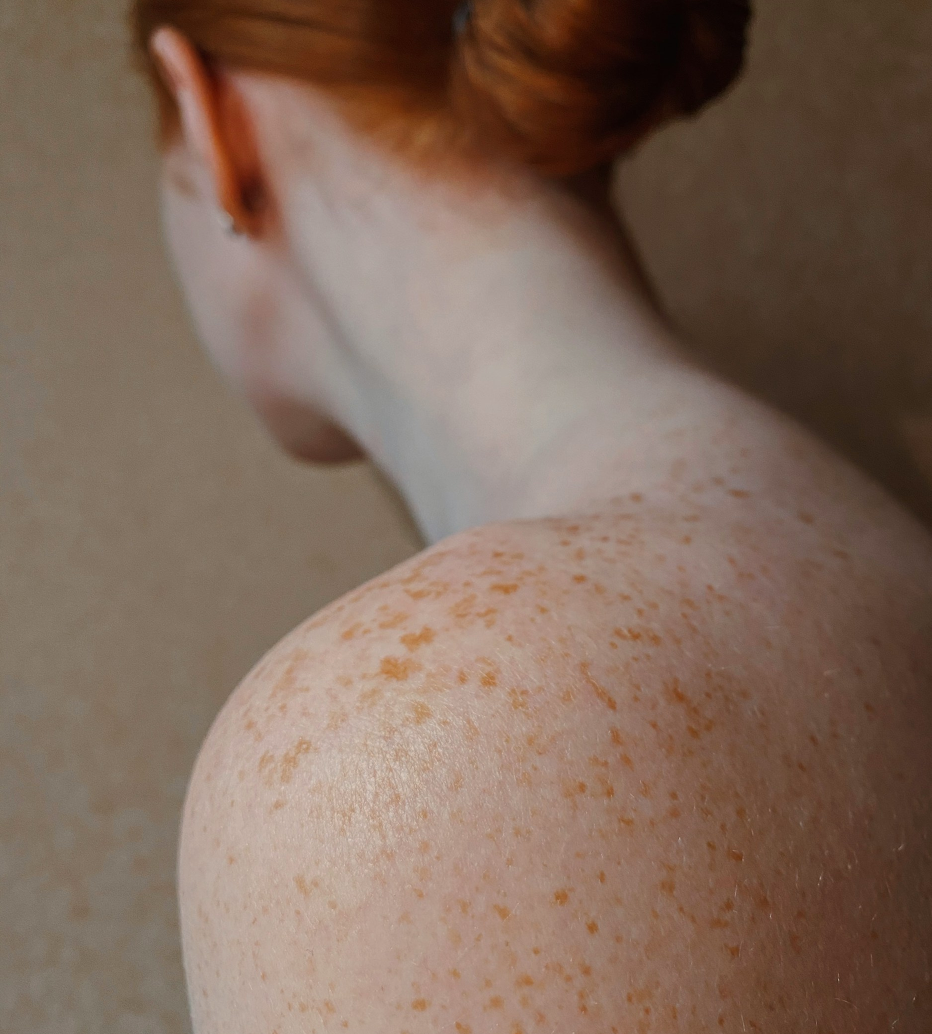 Close-up of a person's freckled shoulder and back with a hand applying a brown exfoliating scrub.