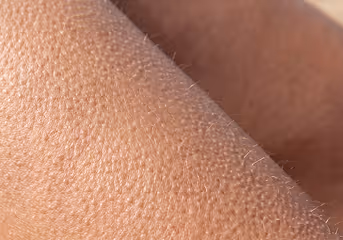 Close-up of human skin with visible hair and pores.