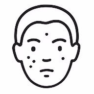 Black and white line drawing of a person's face with acne spots on cheeks and forehead.