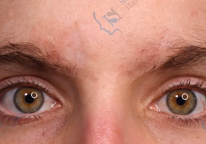 Close-up of a person's face focusing on greenish-brown eyes and natural skin texture.