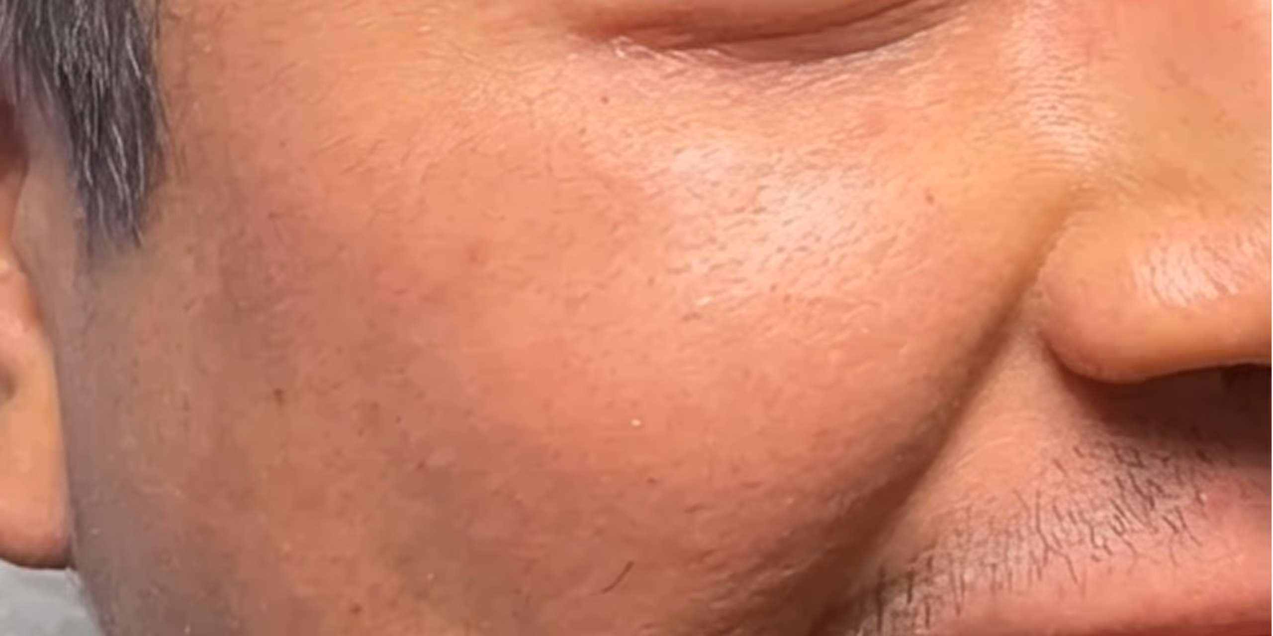 Close-up of a person's cheek, nose, mouth, and part of ear with smooth skin and facial hair.