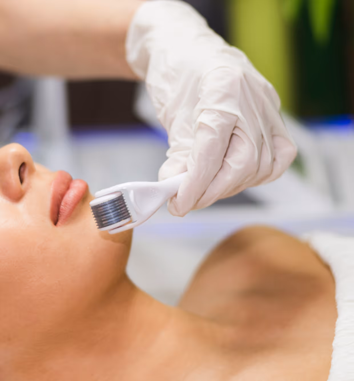 Gloved hand using a derma roller on a person's chin during a skincare treatment.