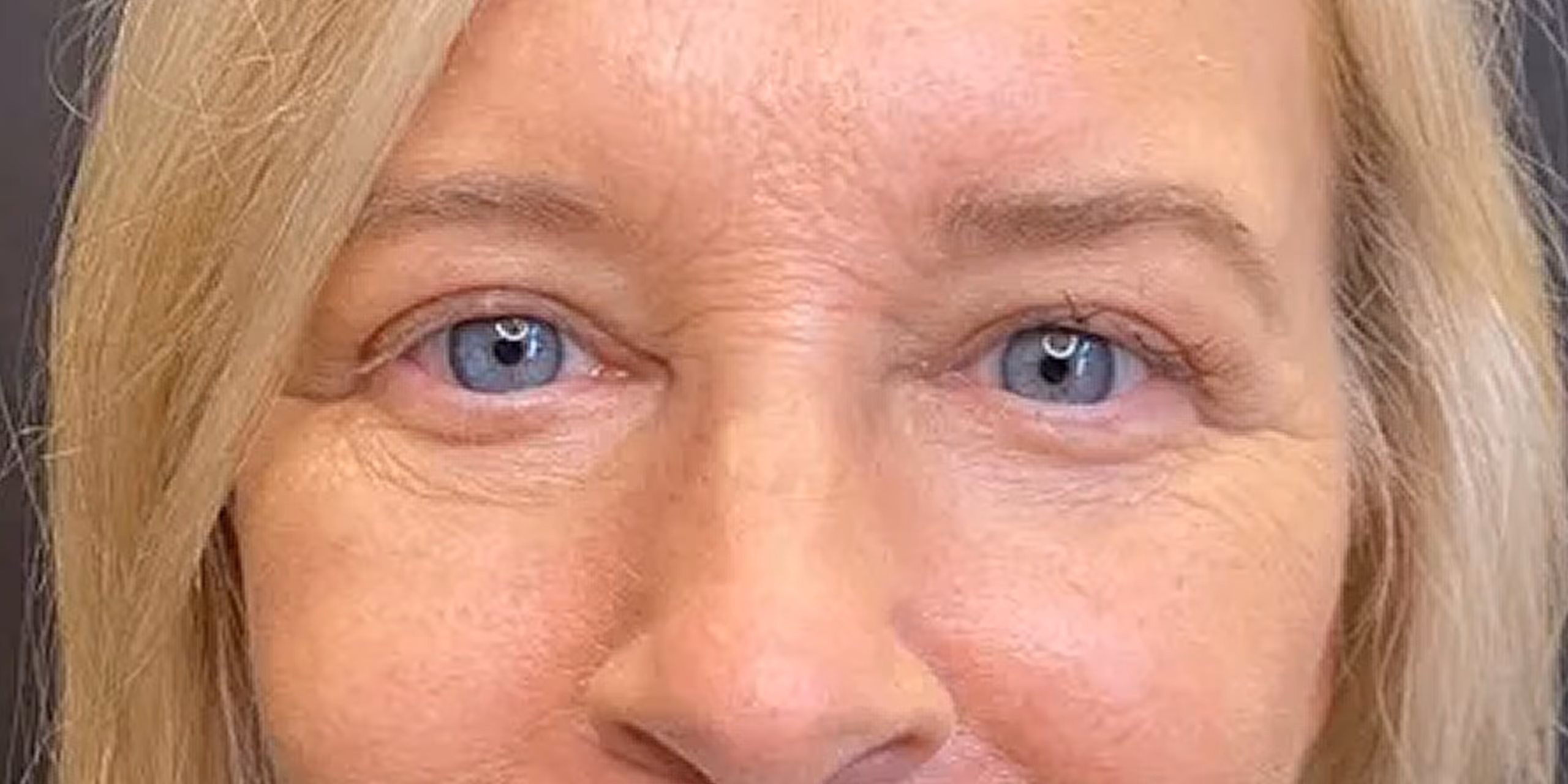 Close-up of a middle-aged woman’s face showing blue eyes, light eyebrows, and blonde hair.