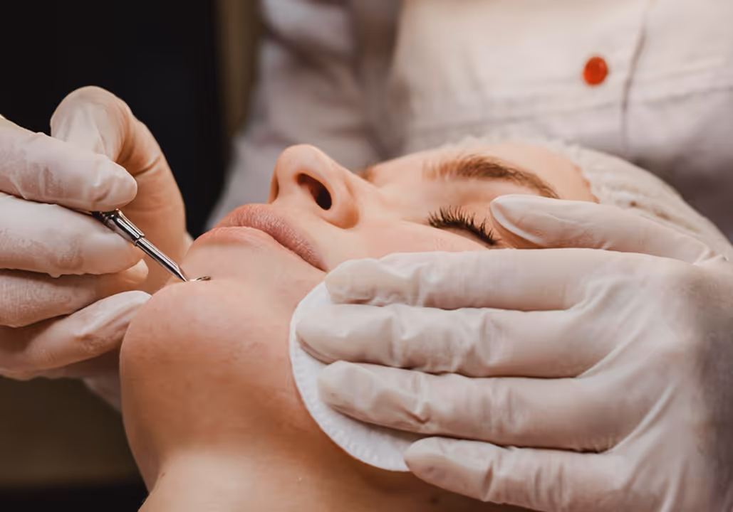 Close-up of a person receiving facial treatment with a tool and cotton pad by a gloved specialist.