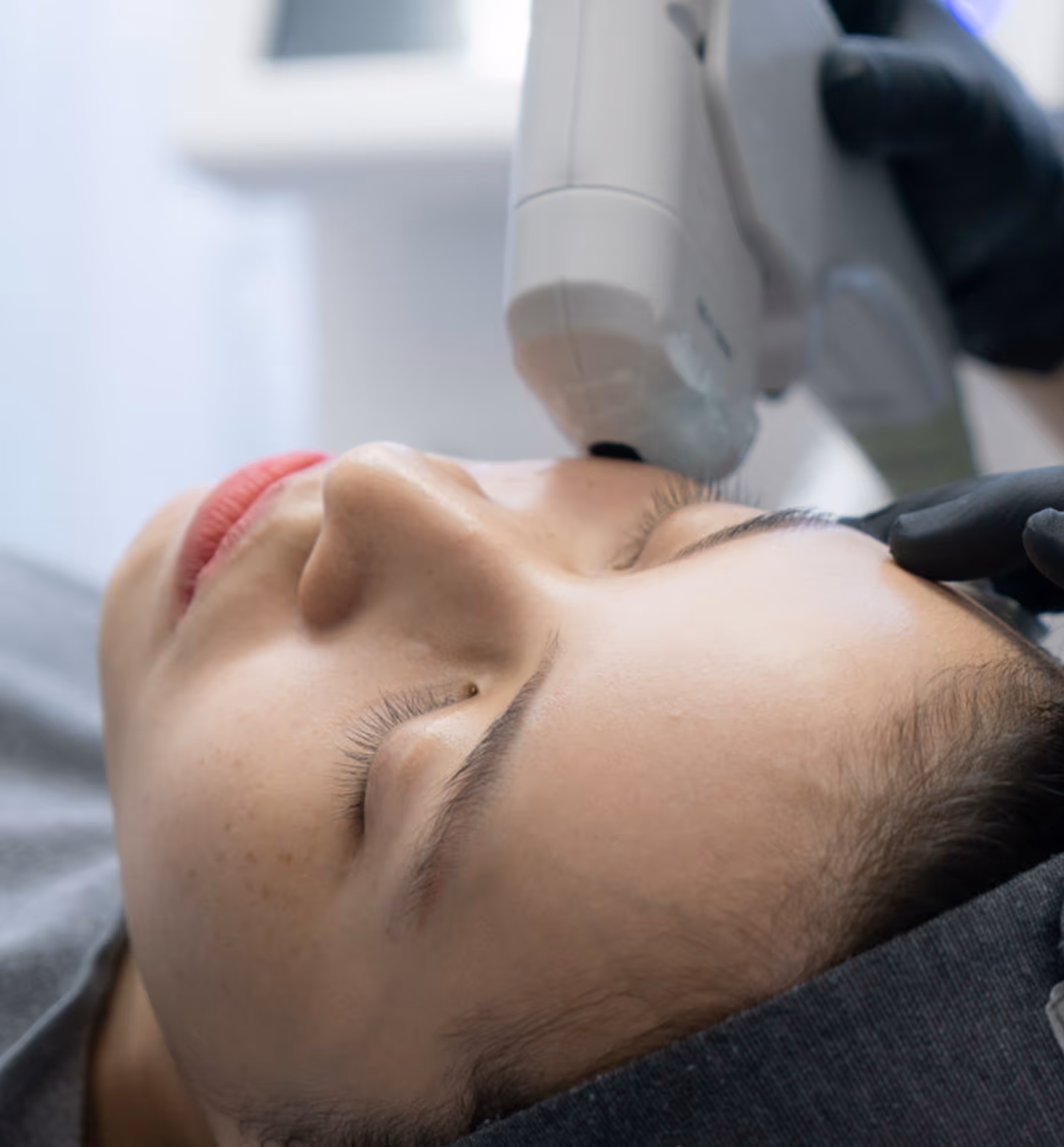 Close-up of woman receiving a facial laser treatment with eyes closed in a clinic.