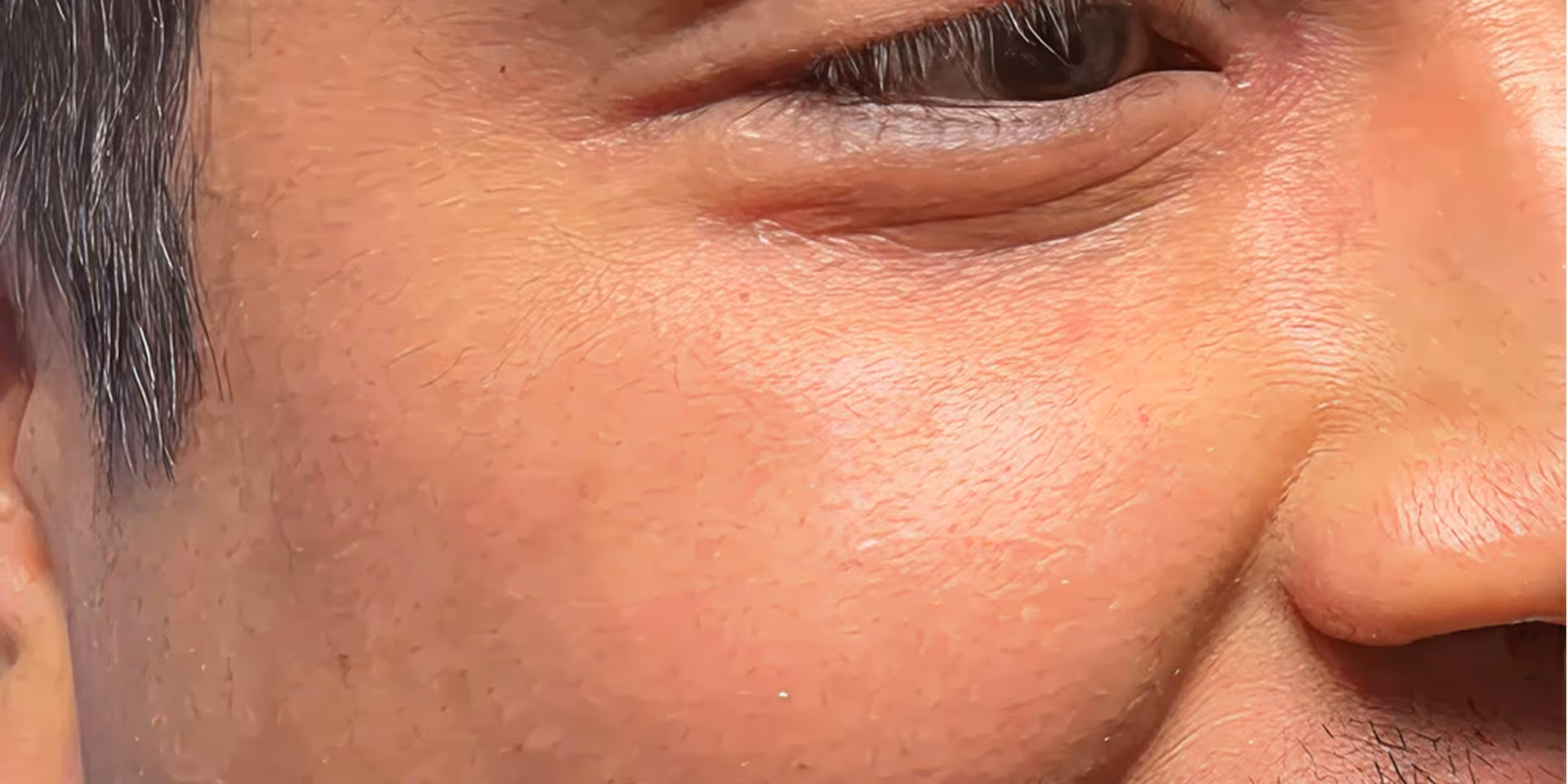 Close-up of a person's smiling eye and cheek showing skin texture and fine hair.