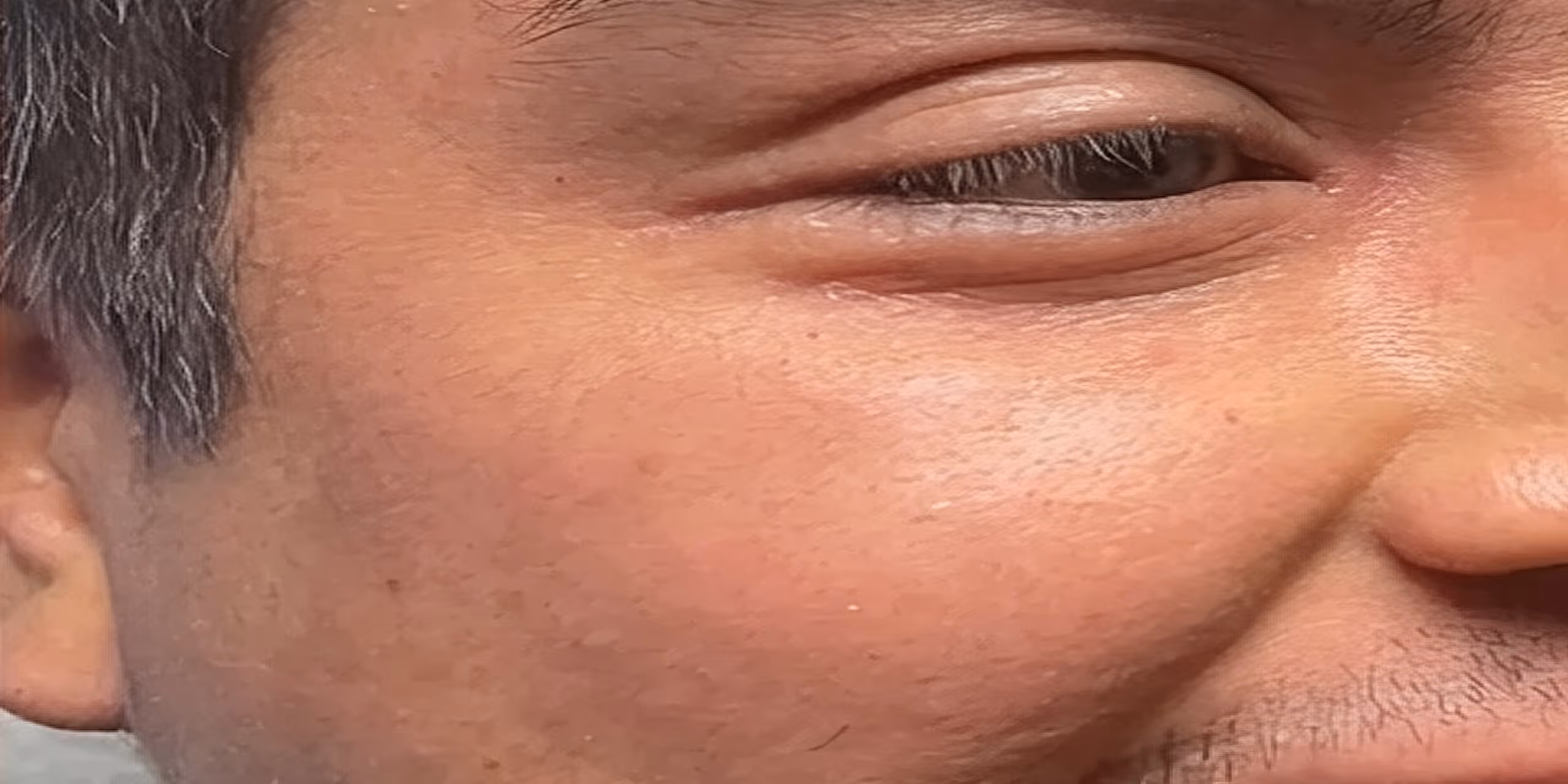 Close-up of a person's smiling eye and cheek showing skin texture and fine hair.