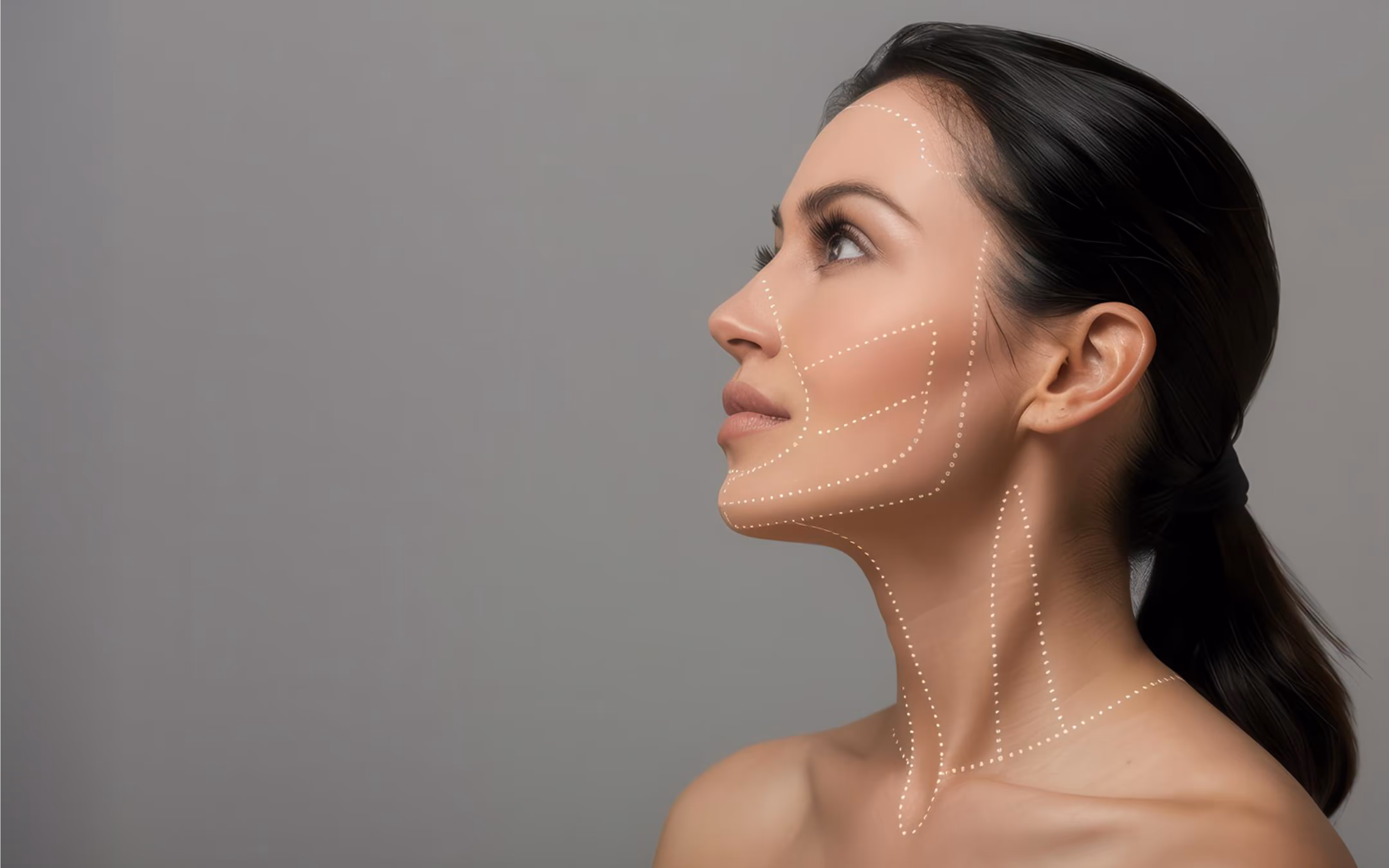 Side profile of a woman with dotted lines marking facial and neck contour areas for cosmetic treatment.